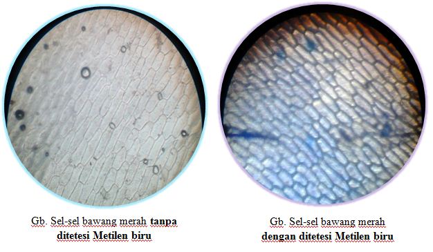 Gambar Sel Tumbuhan Bawang Merah - Gambar Gambar Tumbuhan